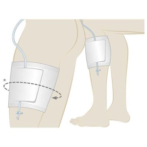 UROMED Beinbeutelhalter 489703 Produktbild
